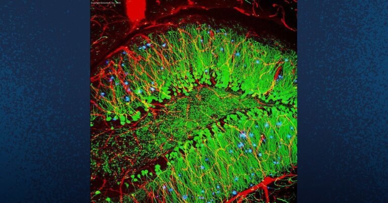 Alzheimer’s Gene Therapy Shows Promise in Preserving Cognitive Function